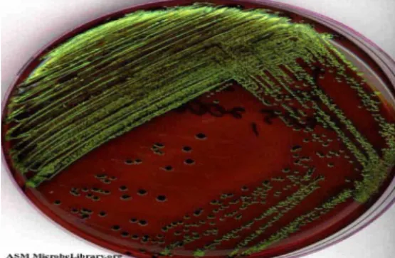 Gambar 2.4. koloni E. coli dengan warna pelangi yang berkilau atau  mengilap seperti logam (metallic sheen) pada agar EMB 