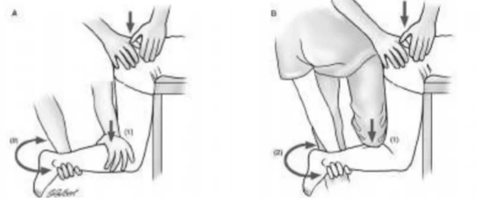 Gambar 10 Manuver Stimson