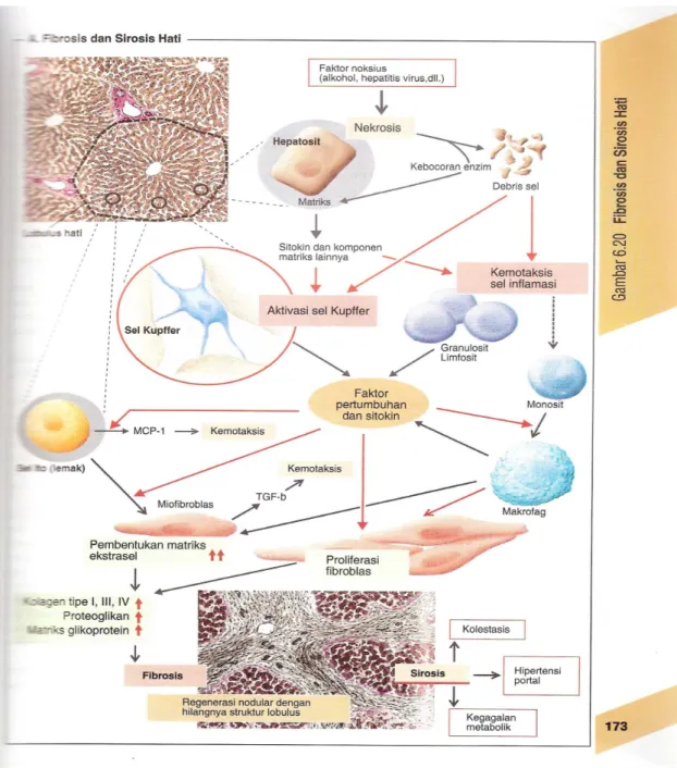 Gambar   1.   Patogenesis   Fibrosis   dan   Sirosis   Hati   (Teks   dan   Atlas   Berwarna  Patofisiologi hal.173)