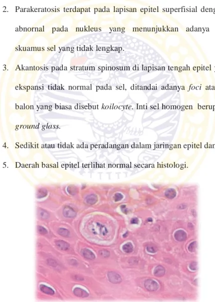 Gambar 2.4 : Gambaran sel balon pada lapisan spinosum (Lewis DM, 2011) 