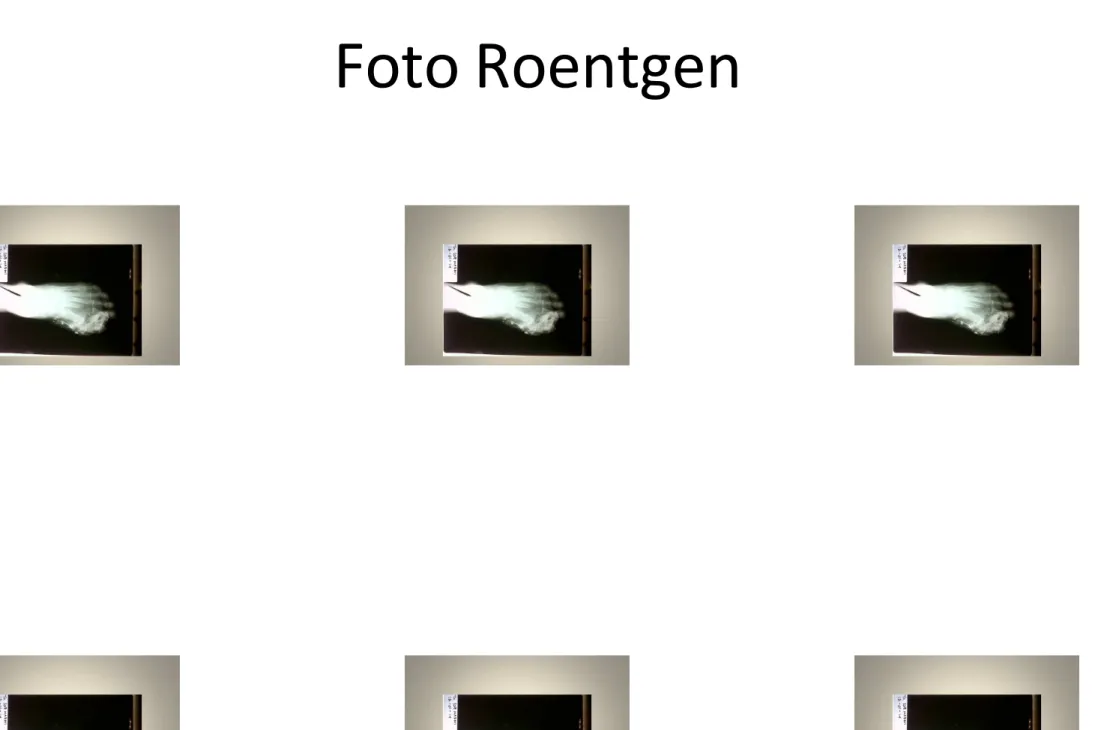 Foto Roentgen