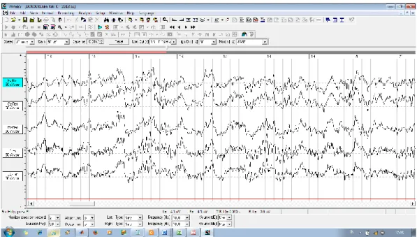 Gambar 3.8 Tampilan sinyal EEG pada WinEEG. 