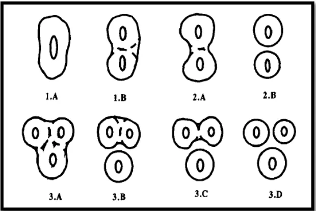 Gambar 2. Komponen morfologi saluran akar pada gigi premolar   satu maksila.7  