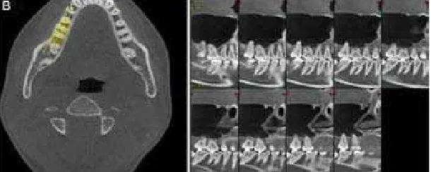 Gambar 8. Tampilan gambaran CBCT.28