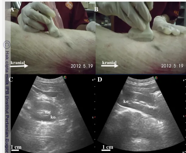 Gambar 4.3  Posisi transduser  pada pemeriksaan ginjal  dengan pasangan  kelenjar   mamari  sebagai  titik  orientasi,  posisi  transduser  transversal  (A)  dengan  hasil sonogram (C)  dan posisi transduser sagital (B) dengan  hasil sonogram