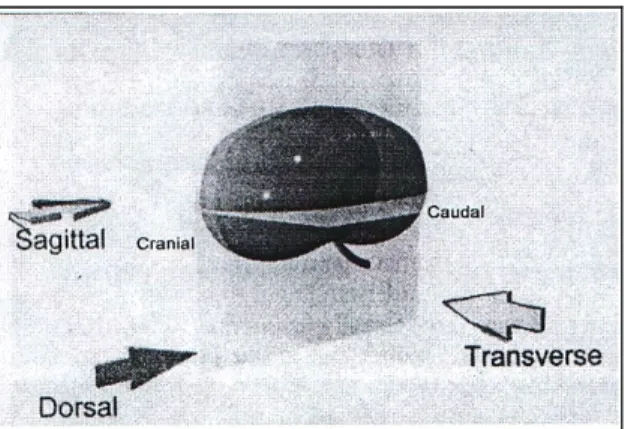 Gambar 5 Tiga arah transducer yang digunakan pada pengambilan gambar USG  organ urinaria (Sumber: Widmer et al
