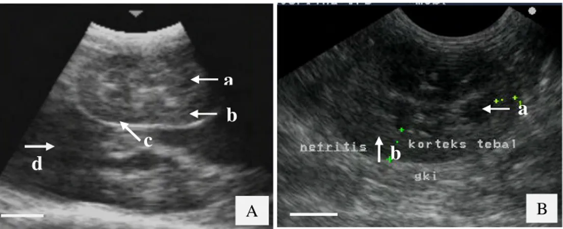 Gambar 12 Sonogram kasus nefritis dengan arah transducer sagital. 