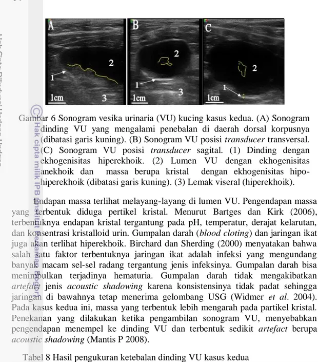Gambar 6 Sonogram vesika urinaria (VU) kucing kasus kedua. (A) Sonogram  dinding  VU  yang  mengalami  penebalan  di  daerah  dorsal  korpusnya  (dibatasi garis kuning)