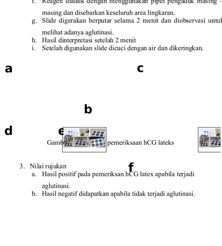 Gambar 3. Cara kerja pemeriksaan hCG lateks