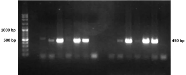 Gambar 1 menunjukkan bahwa berdasarkan  hasil PCR pada daerah L1,  sampel yang positif   terhadap virus papilloma, baik MEP  maupun  beruk, dapat teramplifikasi dengan baik oleh  primer Mac MY26 11 dan Mac MY26 09