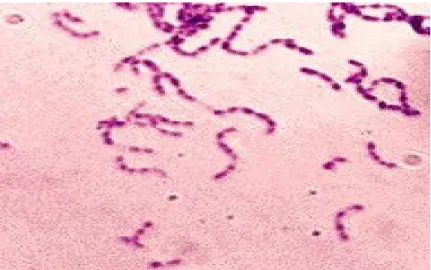 Gambar 6. Streptococcus mutans. Gram stain. CDC 