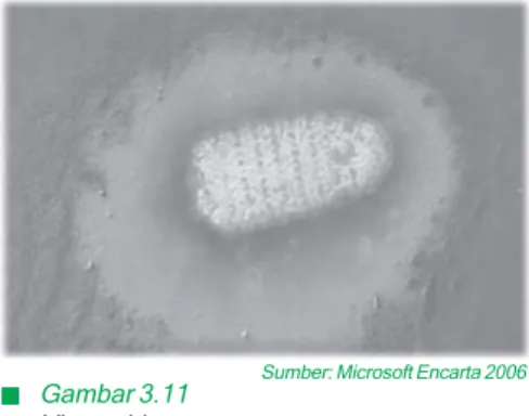 Gambar 3.11 Virus rabies