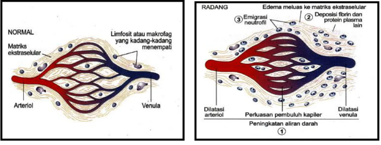 Gambar  4.  Perubahan  vaskular  pada  inflamasi  akut.  A.  Kondisi  vaskular  normal