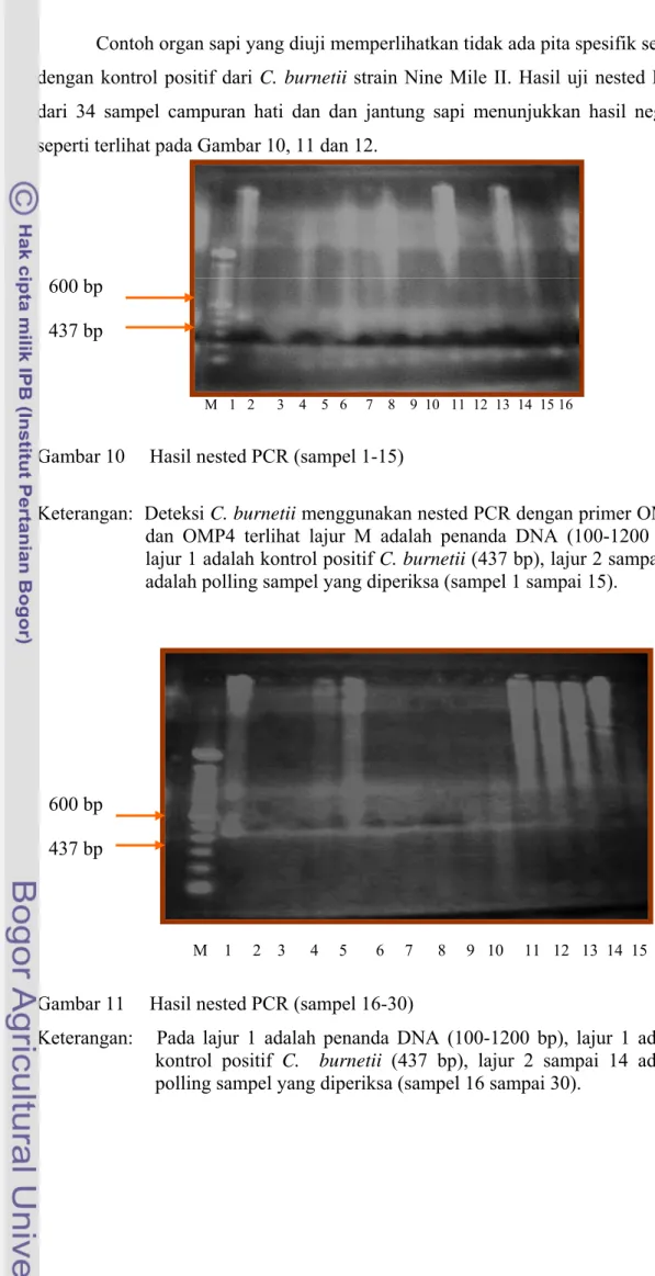 Gambar 10     Hasil nested PCR (sampel 1-15)