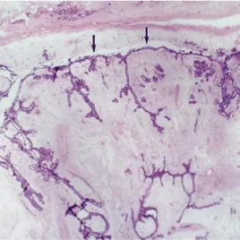 Gambar 6. Gambaran Histopatologi 