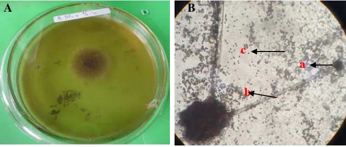 Gambar 1. Koloni Aspergillus sp5. setelah berumur 3 hari pada media PDA (A) dan bentuk mikroskopik (B), konidia (a), konidiofor (b), spora (c) 