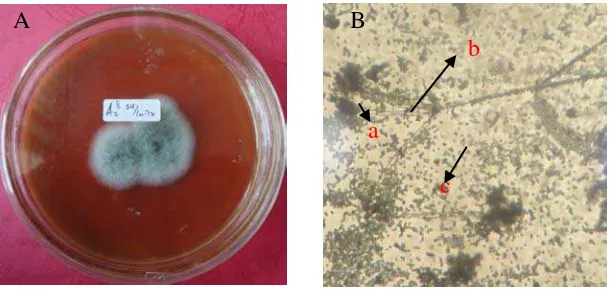 Gambar 2. Koloni Aspergillus sp2. setelah berumur 5 hari pada media PDA (A) dan bentuk mikroskopik (B), konidia (a), konidiofor (b), spora (c) 
