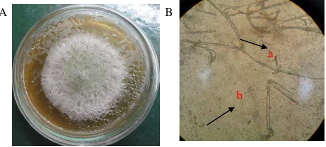 Gambar 3. Koloni Cladosporium sp2. setelah berumur 5 hari pada media PDA (A) dan bentuk mikroskopik (B), spora (a), konidiofor (b) 
