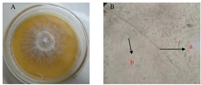 Gambar 5. Koloni Acremonium sp. setelah berumur 7 hari pada media PDA dan bentuk mikroskopik (B), konidiofor (a), spora (b) 