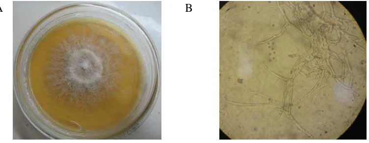 Gambar 1. Fungi endofit yang ditemukan pada sample DT2 yang dilihat secara makroskopis (A) dan secara mikroskopis (B) 