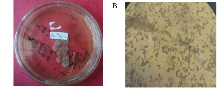 Gambar 5. Fungi endofit yang ditemukan pada sample B3 yang dilihat secara makroskopis (A) dan secara mikroskopis (B) 