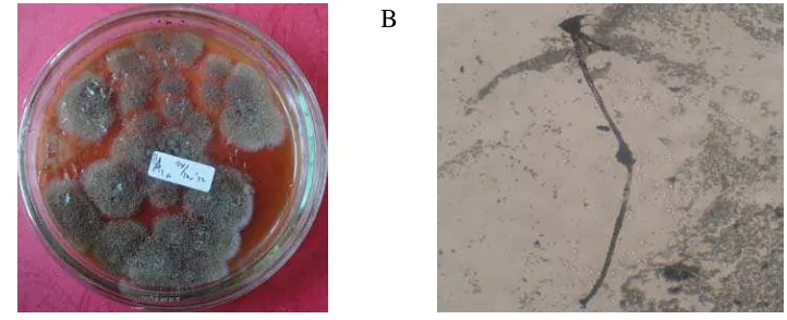 Gambar 7. Fungi endofit yang ditemukan pada sample DT1a yang dilihat secara makroskopis (A) dan secara mikroskopis (B) 