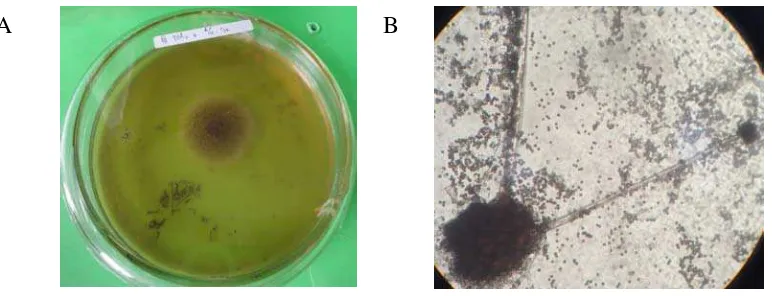 Gambar 10. Fungi endofit yang ditemukan pada sample A1b yang dilihat secara makroskopis (A) dan secara mikroskopis (B) 