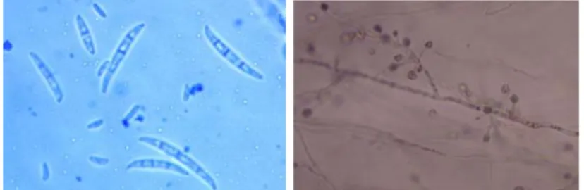 Gambar 6  F.  oxysporum : A mikrokonidia (1) dan makrokonidia (2),                   B kumpulan mikrokonidia (3) dan konidiofora (4) 