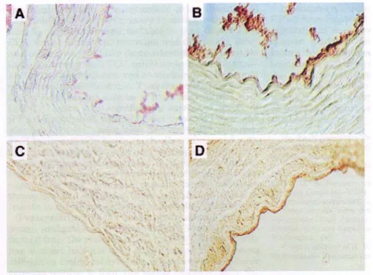 Gambar 9. Potongan melintang aorta pada binatang usia 10 minggu. A: tikus   Dengan jaringan normal; B: tikus dengan peroksinitrite; C: tikus dengan   defisiensi GPx-1; D:tikus dengan defisiensi GPx-1setelah terapi