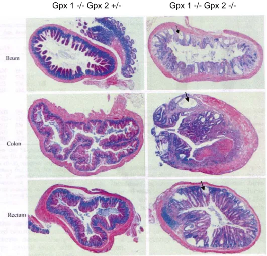 Gambar 11. Histologi ileum, kolon dan rektum tikus. Gambar sebelah kiri  memperlihatkan jaringan normal, gambar sebelah kanan jaringan pada tikus  dengan defisiensi