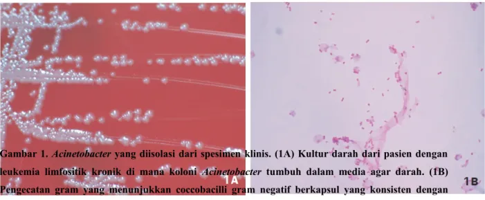 Gambar 1. Acinetobacter yang diisolasi dari spesimen klinis. (1A) Kultur darah dari pasien dengan leukemia limfositik  kronik  di  mana koloni  Acinetobacter  tumbuh  dalam media agar darah