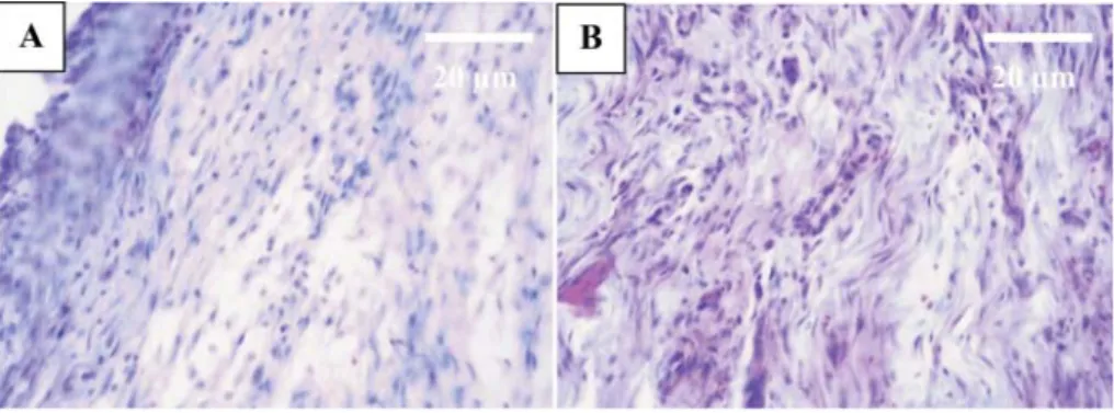 Fig. 1. Note the connective tissue formation with large numbers of ﬁ broblasts and ﬁ brocytes in  the treated tendon (A) and untreated tendon (B) after the ﬁ rst week