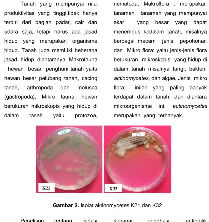 Gambar 2. Isolat aktinomycetes K21 dan K32 
