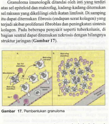 Gambar  17.  Pembentukan  granuloma