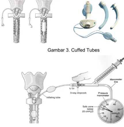 Gambar 3. Cuffed Tubes