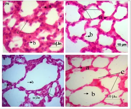 Gambar 4.5 Efek Asap Rokok Elektrik terhadap Mikroanatomi Paru-paru             Mencit (Mus musculus L.), P0 (kontrol), 1, 2, 3 (skor derajat             kerusakan), Pewarnaan HE, Perbesaran 400x, 10 μm, (a) membran (b)             lumen alveolus (c) hubungan antar alveolus  