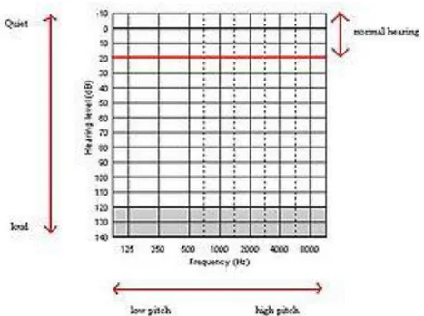 Gambar 10. Audiogram normal AC Air conduction telinga kiri dan kanan (AC&lt;25db) 