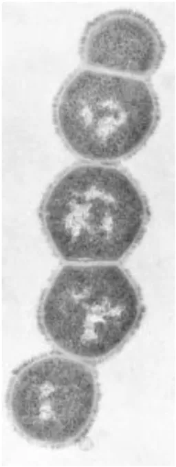 Gambar 6. Bakteri Sterptokokus  10