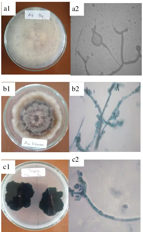 Gambar 2.  Isolat Jamur Endofit daun beluntas (Pluchea indica (L.) Less.). Diperoleh tigas isolat jamur endofit, yaitu (a1) Isolat Jamur Endofit Putih, (a2) hasil pengamatan Mikroskopik Isolat Jamur Endofit Putih, (b1) Isolat Jamur Endofit Hitam 1, (b2) ha