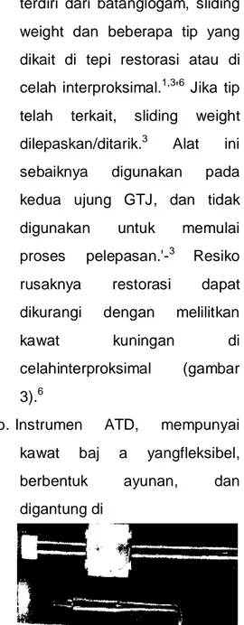 Gambar  3.  Ligatur  dikait  ke  pelepas 