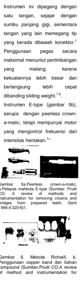 Gambar  5a.Peerless  crown-a-matic,  b.Pelepas  mahkota  E-type  (Sumber:  Pruitt  CO