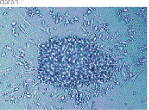 Gambar 2 Koloni EPC yang memiliki karakteristik bagian  tengah bulat dikelilingi sel-sel berbentuk spindel  (perbesa-ran 200x, dengan mikroskop fase kontras) 18