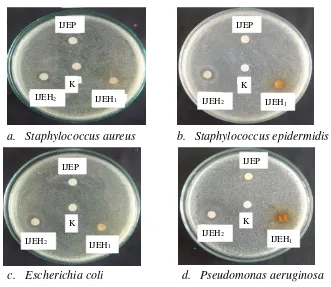 Gambar 1. Hasil Uji Aktivitas Antibakteri Isolat Jamur Endofit dari Daun Beluntas.  K = Kontrol negatif, IJEP = Isolat Jamur Endofit Putih, IJEH1 = Isolat Jamur Endofit Hitam 1, IJEH2 = Isolat Jamur Endofit Hitam 2