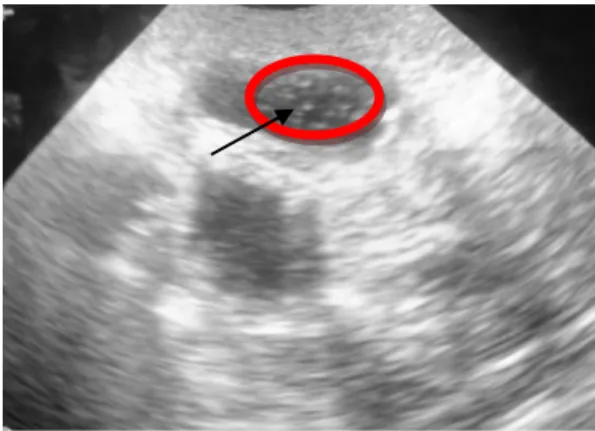 Gambar 1. Hasil Pemeriksaan ultrasonografi terlihat bentukan masa echogenitasnya  hypoechoic pada vesica urinaria 