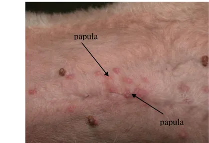 Gambar 5  Papulae pada gejala awal skabies       (Sumber : Bentley 2001) 