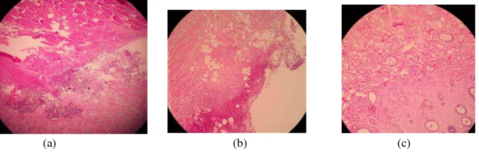 Gambar 13. Gambaran histologi penyembuhan luka pada hari ke-14, perlakuan kontrol (a), MEBO(b), Aloe Vera (c) 