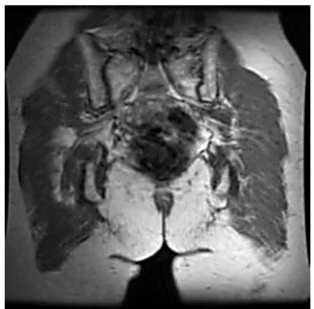 Foto MRI 
