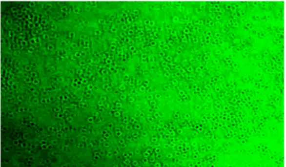 Gambar 4.  Kristal formazan yang terbentuk dari  hasil reduksi senyawa  MTT oleh enzim   dehidrogenase mitokondria sel limfosit 