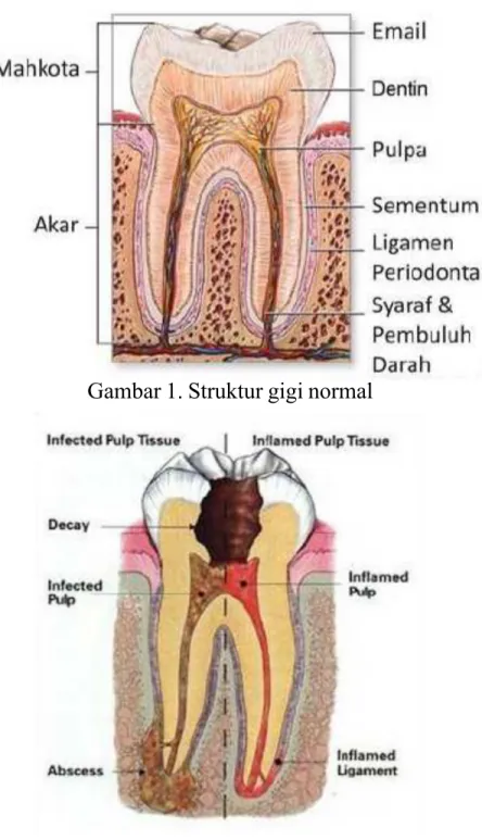 Gambar 1. Struktur gigi normal
