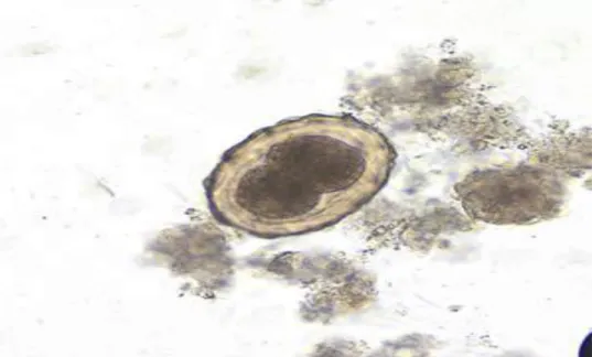 Gambar 1. Telur cacing Ascaris lumbricoides 